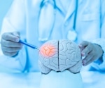 New Research Highlights Brain Connectivity as Key Factor in Cognitive Aging