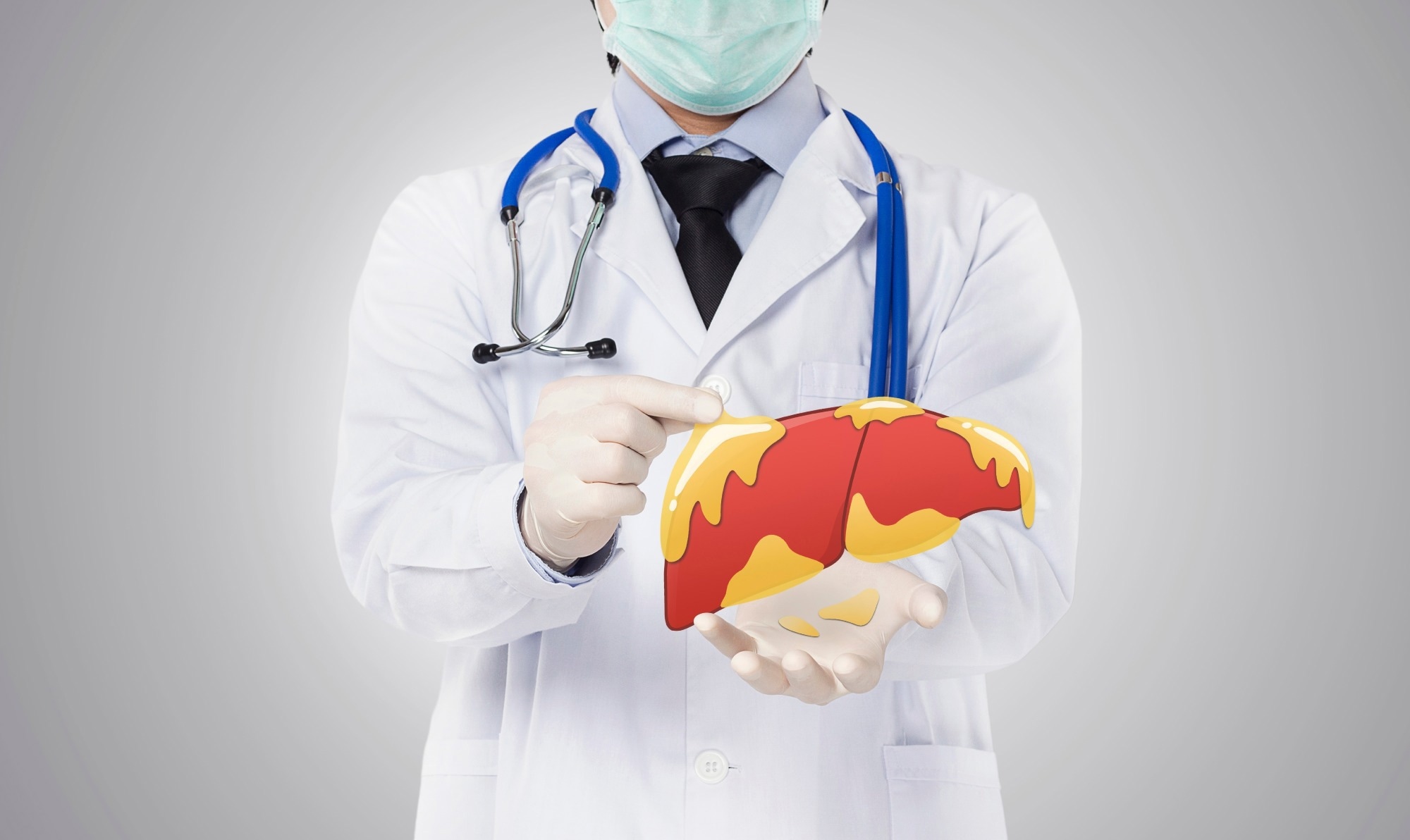 ​​​​​​​Study: Decreasing the Burden of Non-Alcoholic Fatty Liver Disease: from Therapeutic Targets to Drug Discovery Opportunities. Image Credit: SoftSheep/Shutterstock.com