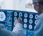 Deep-Learning Model Identifies Parkinson's Disease-Specific Neuroanatomical Features