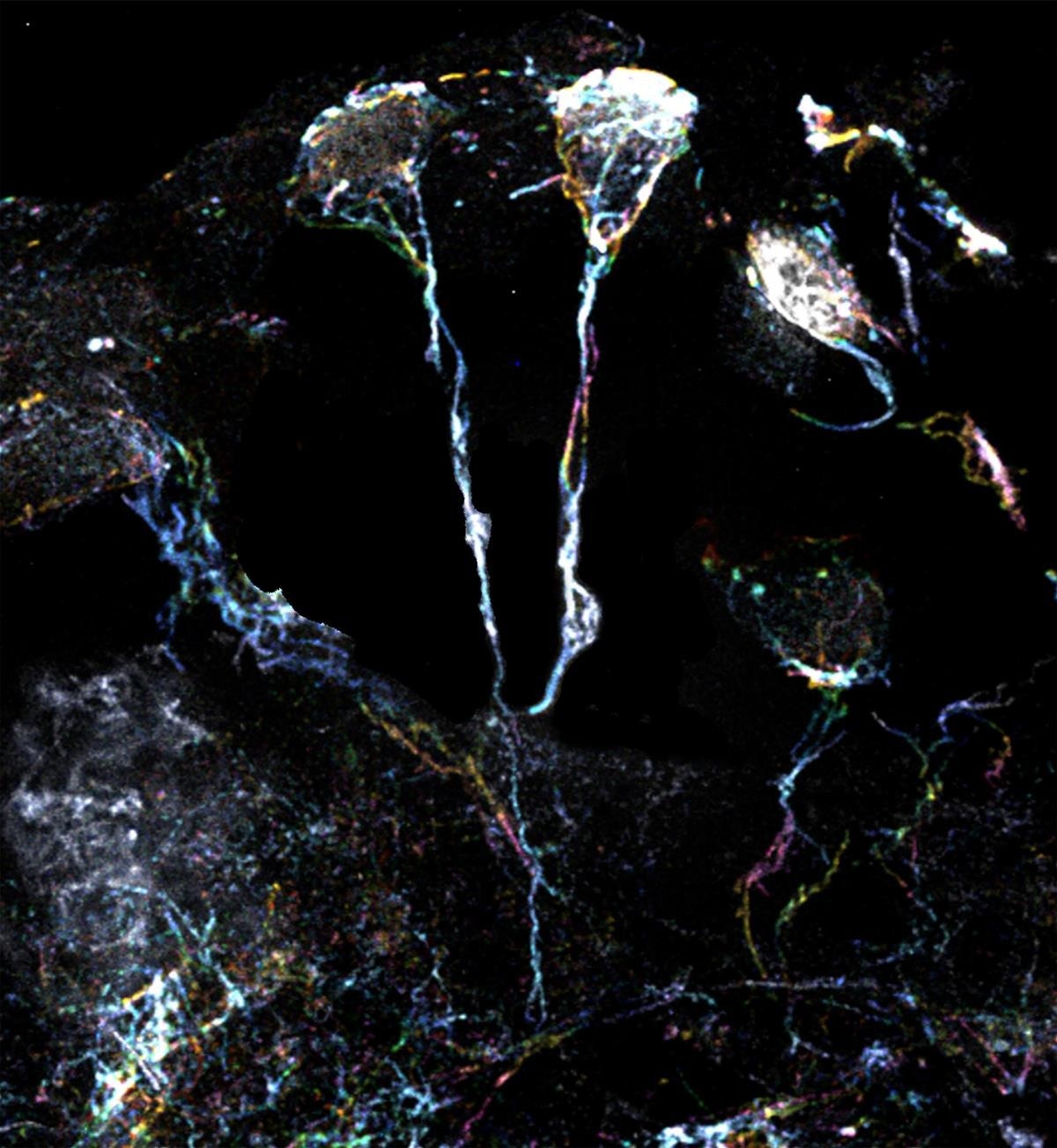 Astrocytes Emerge as Key Players in Brain Health and Development