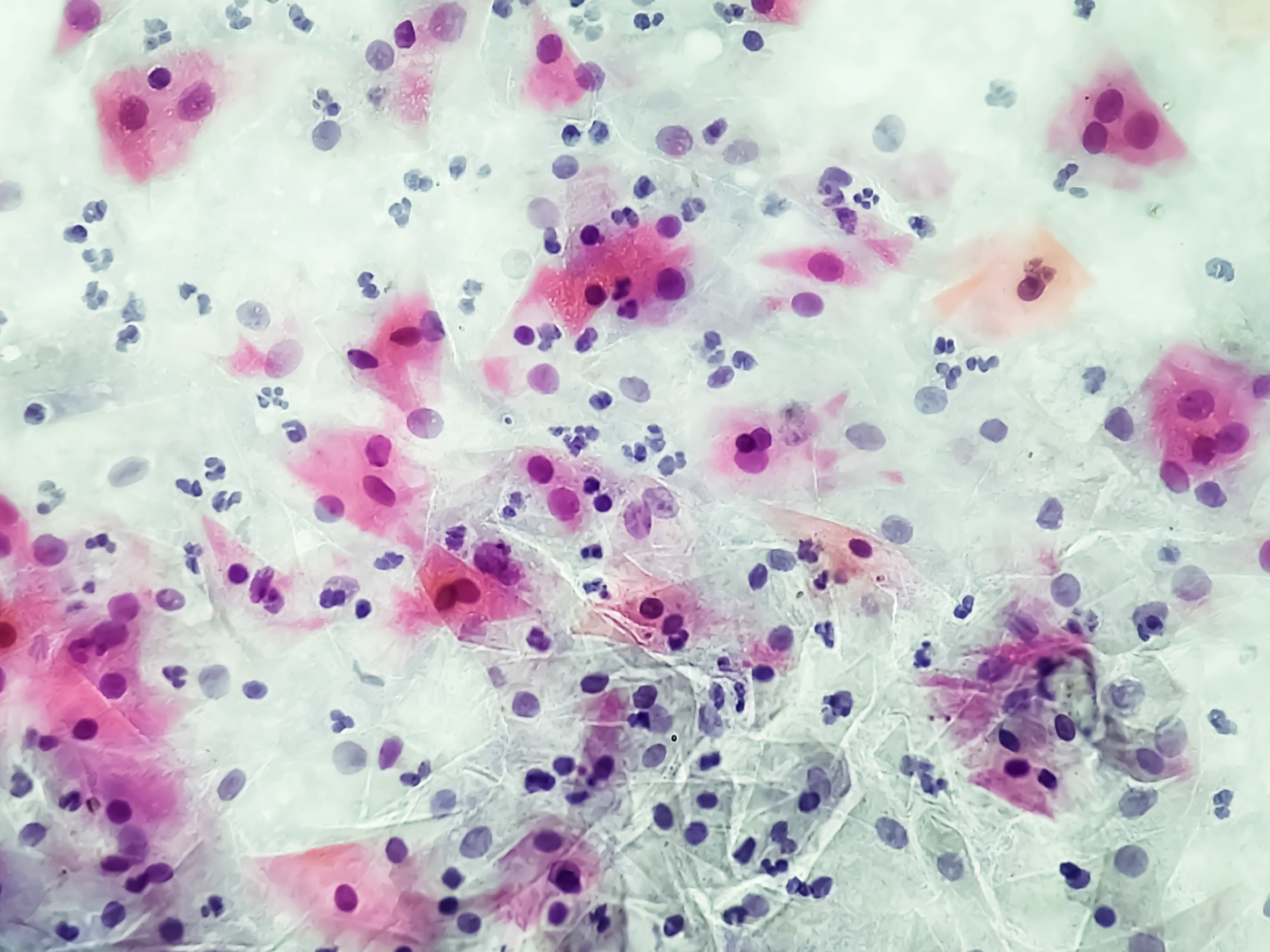 Study: Computational approach for drug discovery against Gardnerella vaginalis in quest for safer and effective treatments for bacterial vaginosis. Image Credit: Saiful52/Shutterstock.com