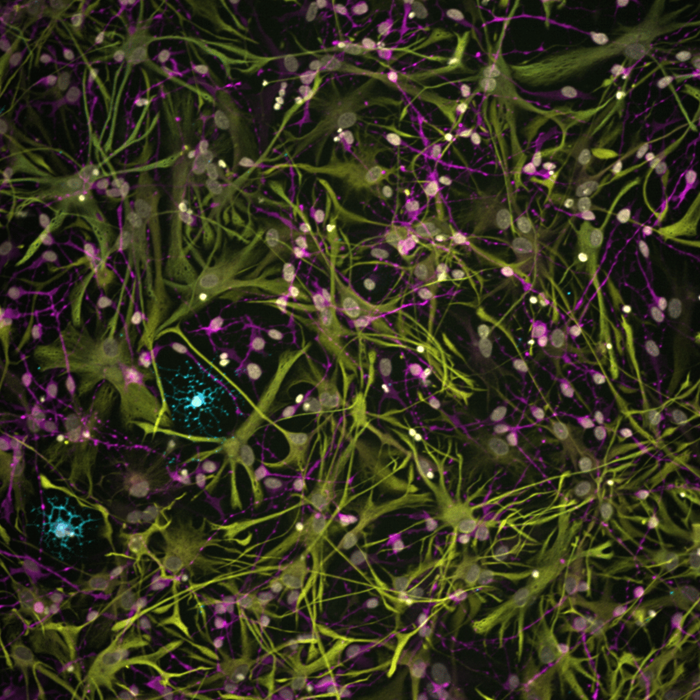 Innovative Stem Cell Research Unveils Glial Cell Dynamics in Multiple Sclerosis