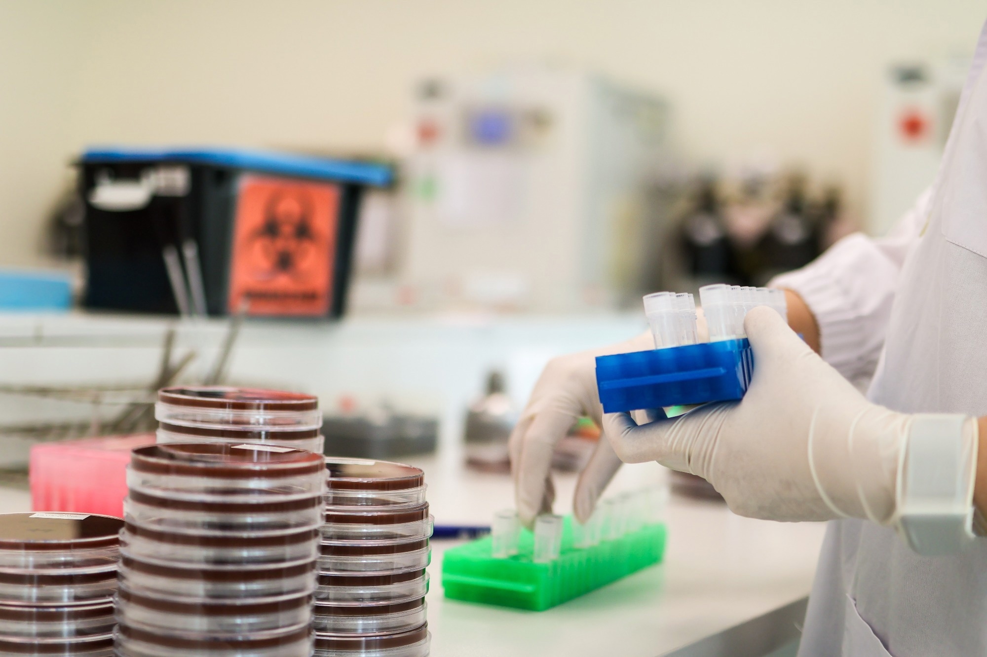 ​​​​​​​Study: Pan-pathogen deep sequencing of nosocomial bacterial pathogens in Italy in spring 2020: a prospective cohort study. Image Credit: enuengneng/Shutterstock.com