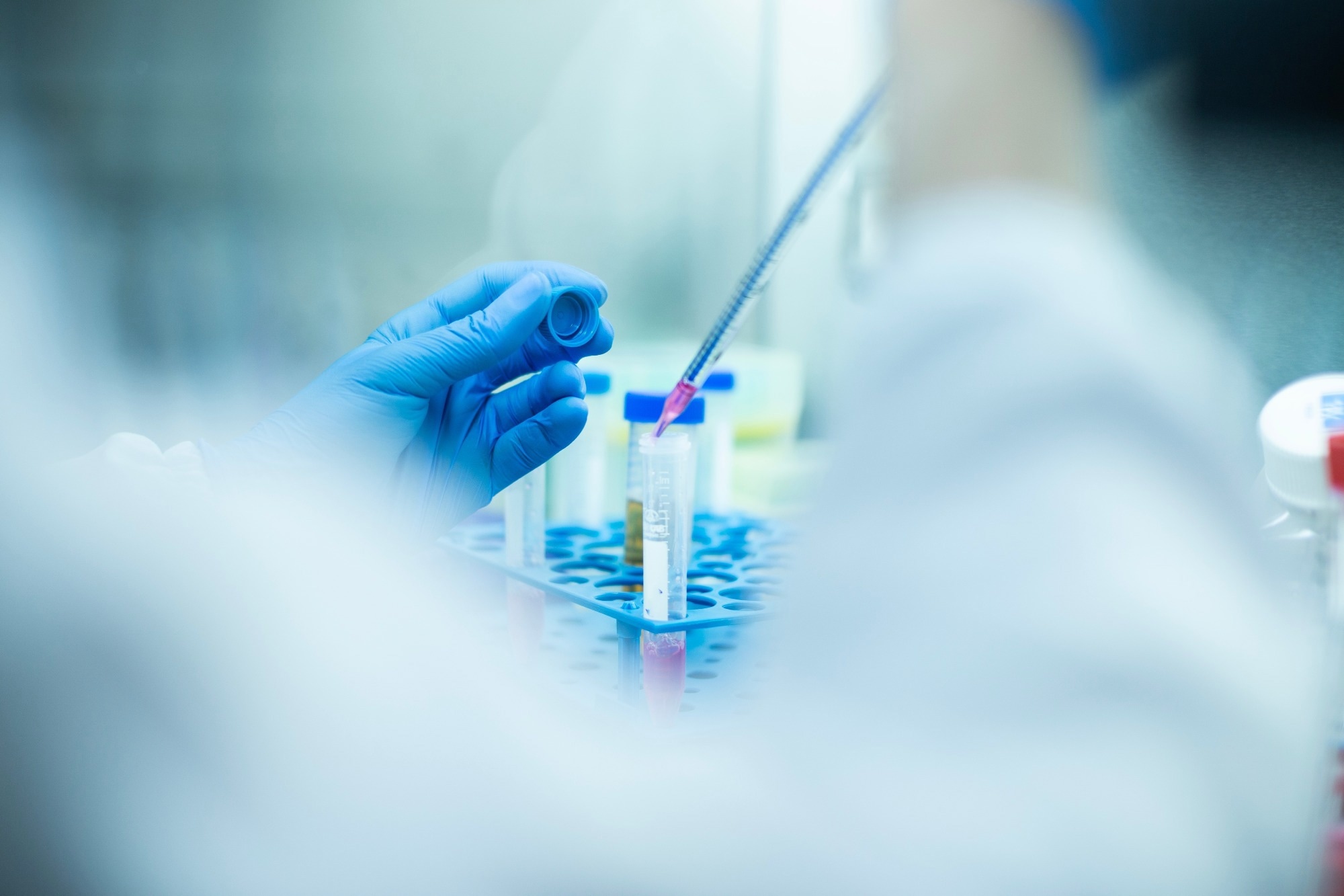 ​​​​​​​Study: Advancements and challenges in stem cell transplantation for regenerative medicine. Image Credit: alicancomertpay/Shutterstock.com