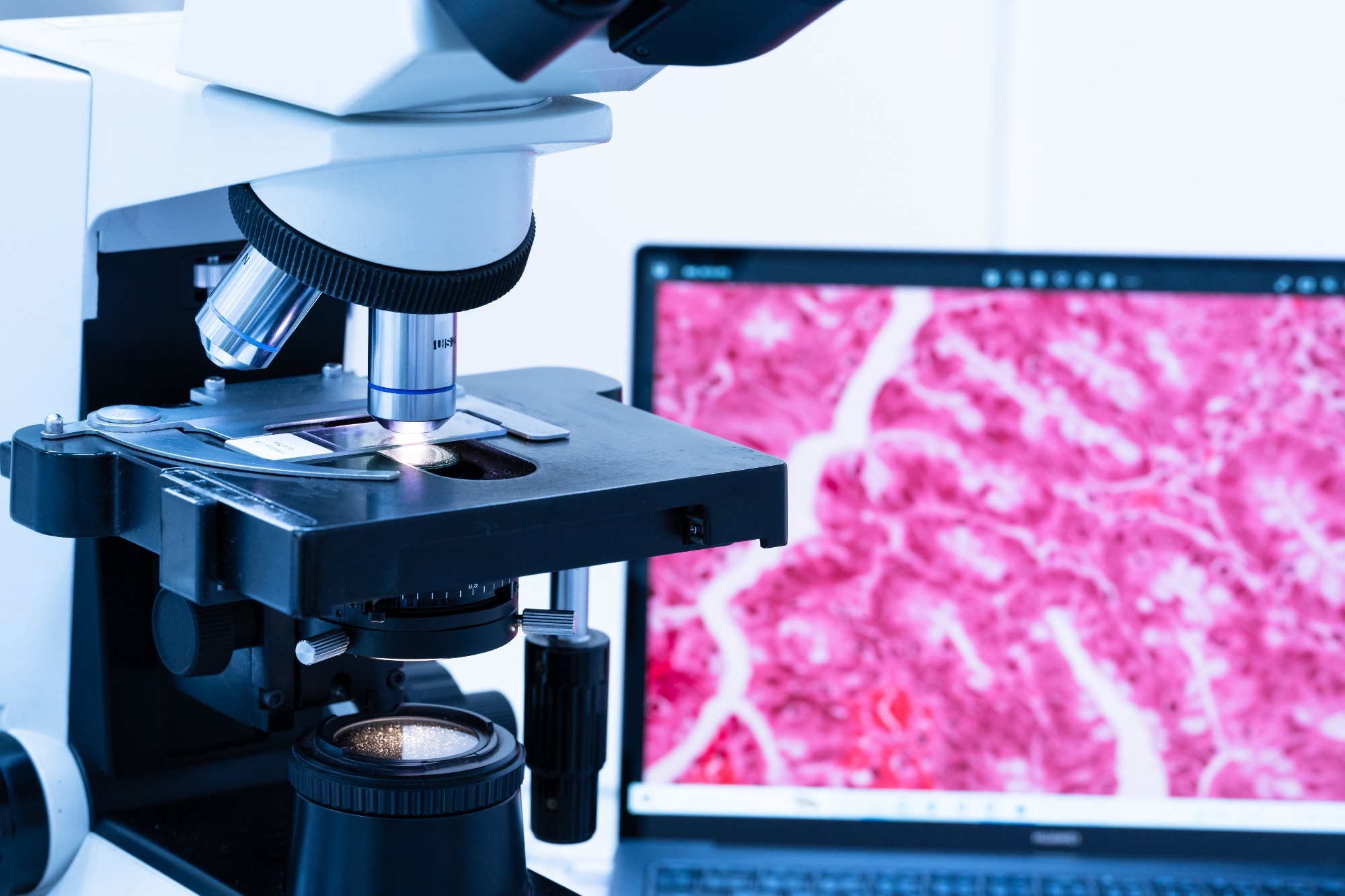 ​​​​​​​Study: A pathology foundation model for cancer diagnosis and prognosis prediction. Image Credit: Komsan Loonprom/Shutterstock.com