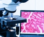 CHIEF Model Transforms Cancer Evaluation with Enhanced Generalizability Across Diverse Histopathology Samples