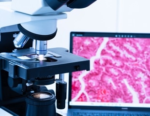 CHIEF Model Transforms Cancer Evaluation with Enhanced Generalizability Across Diverse Histopathology Samples