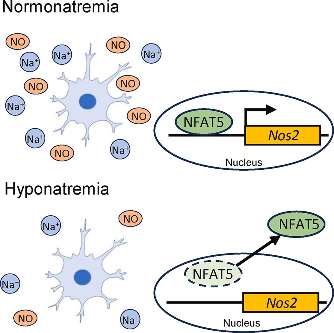 New Insights into the Pathogenesis of Osmotic Demyelination Syndrome
