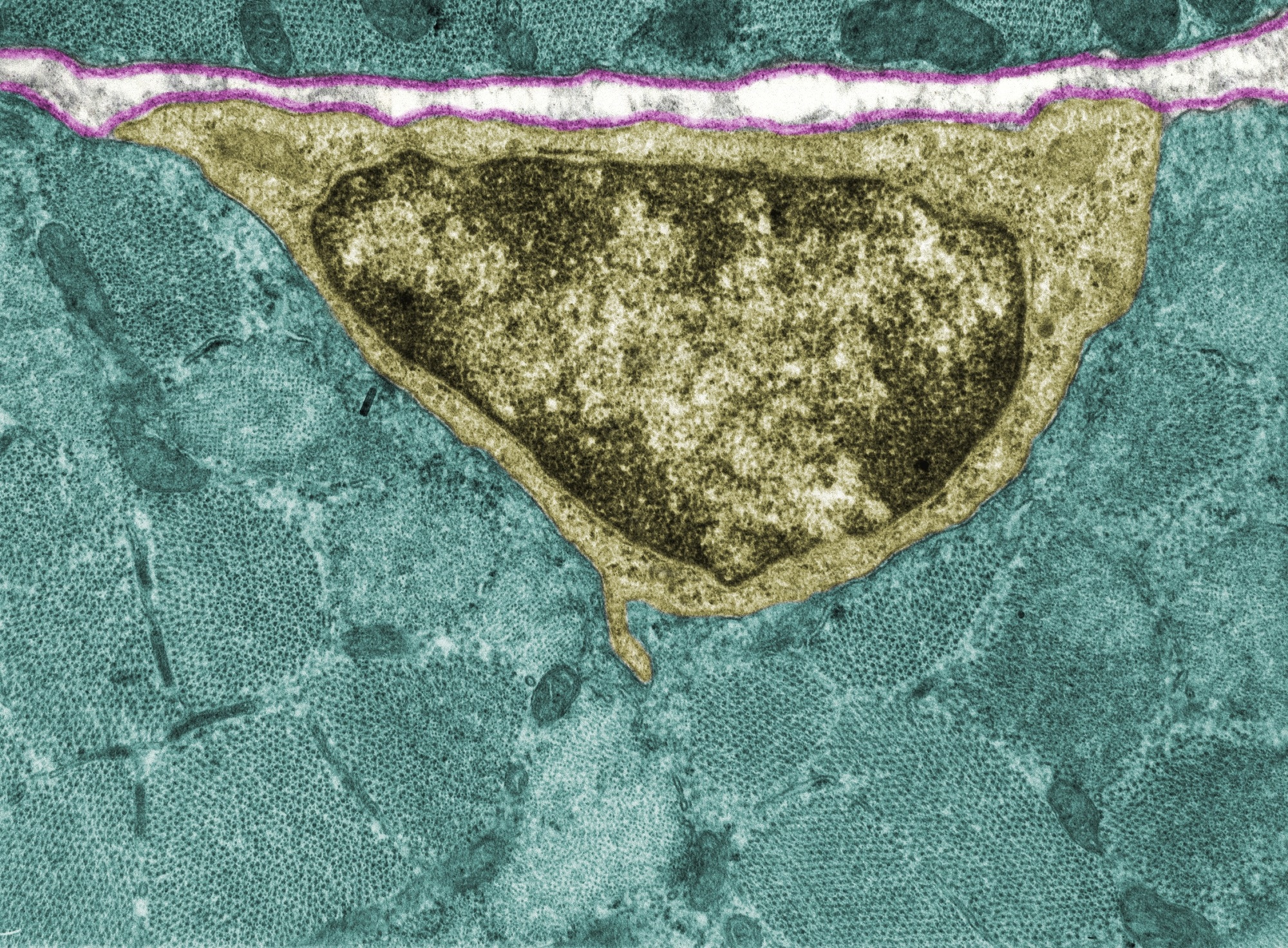 Study: Organoid culture promotes dedifferentiation of mouse myoblasts into stem cells capable of complete muscle regeneration. Image Credit: Jose Luis Calvo/Shutterstock.com