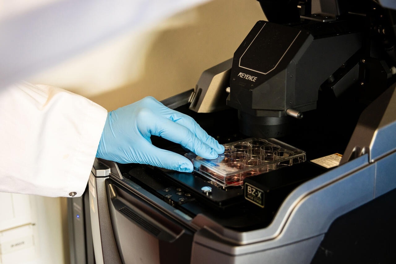 The Evolutionary Secrets of Human Hearts