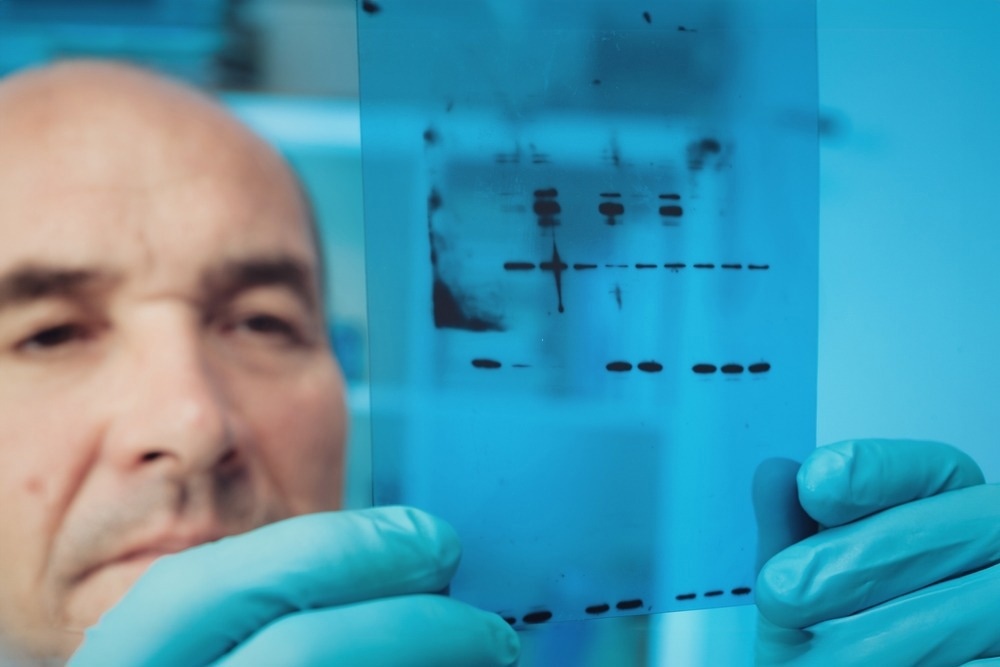 western blot
