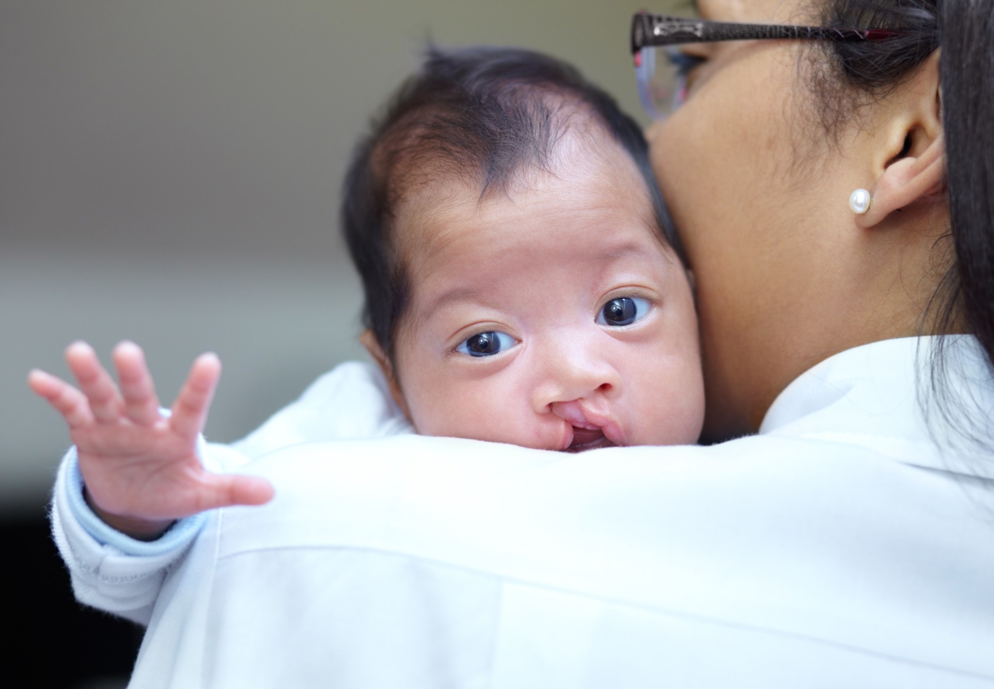 ​​​​​​​Study: Proteomic analysis illustrates the potential involvement of motor proteins in cleft palate development. Image Credit: PeopleImages.com - Yuri A/Shutterstock.com