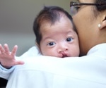 Motor And Extracellular Matrix Proteins Play A Critical Role In Cleft Palate Formation