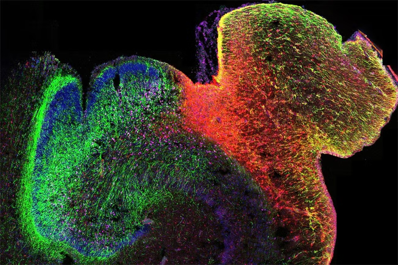New Insights Into How Early Brain Development Influences Mental Health New Insights Into How Early Brain Development Influences Mental Health