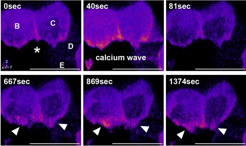 A Novel Mechanism for Apoptotic Cell Removal in Epithelial Tissues
