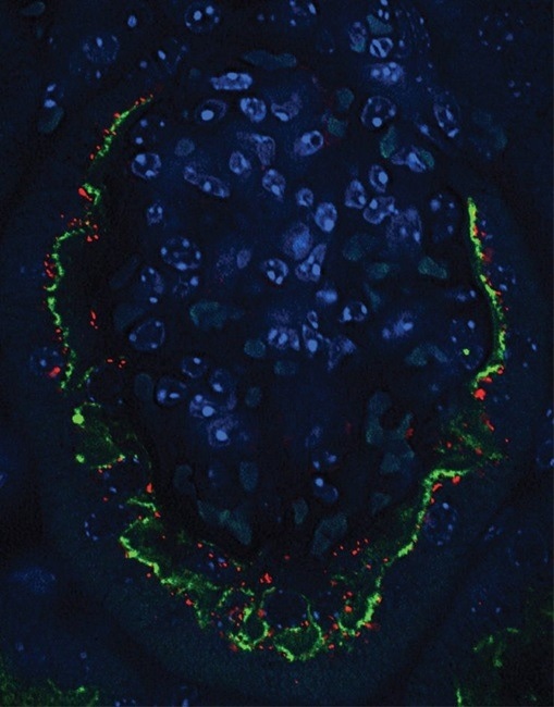 Unveiling the Protective Role of KLF6 in Diabetic Kidney Disease