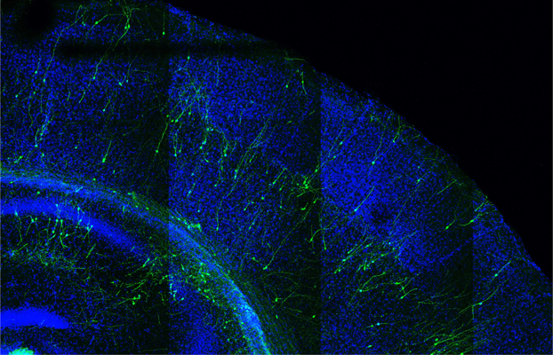 Mutant Neurons Show Accelerated Development in Mouse Brain