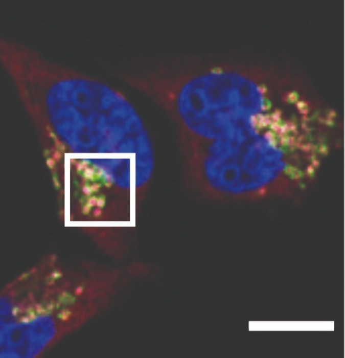 Scientists Discover a Hidden Ally in the Fight Against Cancer