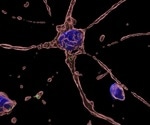 Hepatitis E Virus Impairs Neuronal Cells, Reducing Neurite Length