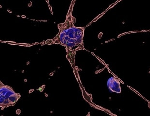 Hepatitis E Virus Impairs Neuronal Cells, Reducing Neurite Length