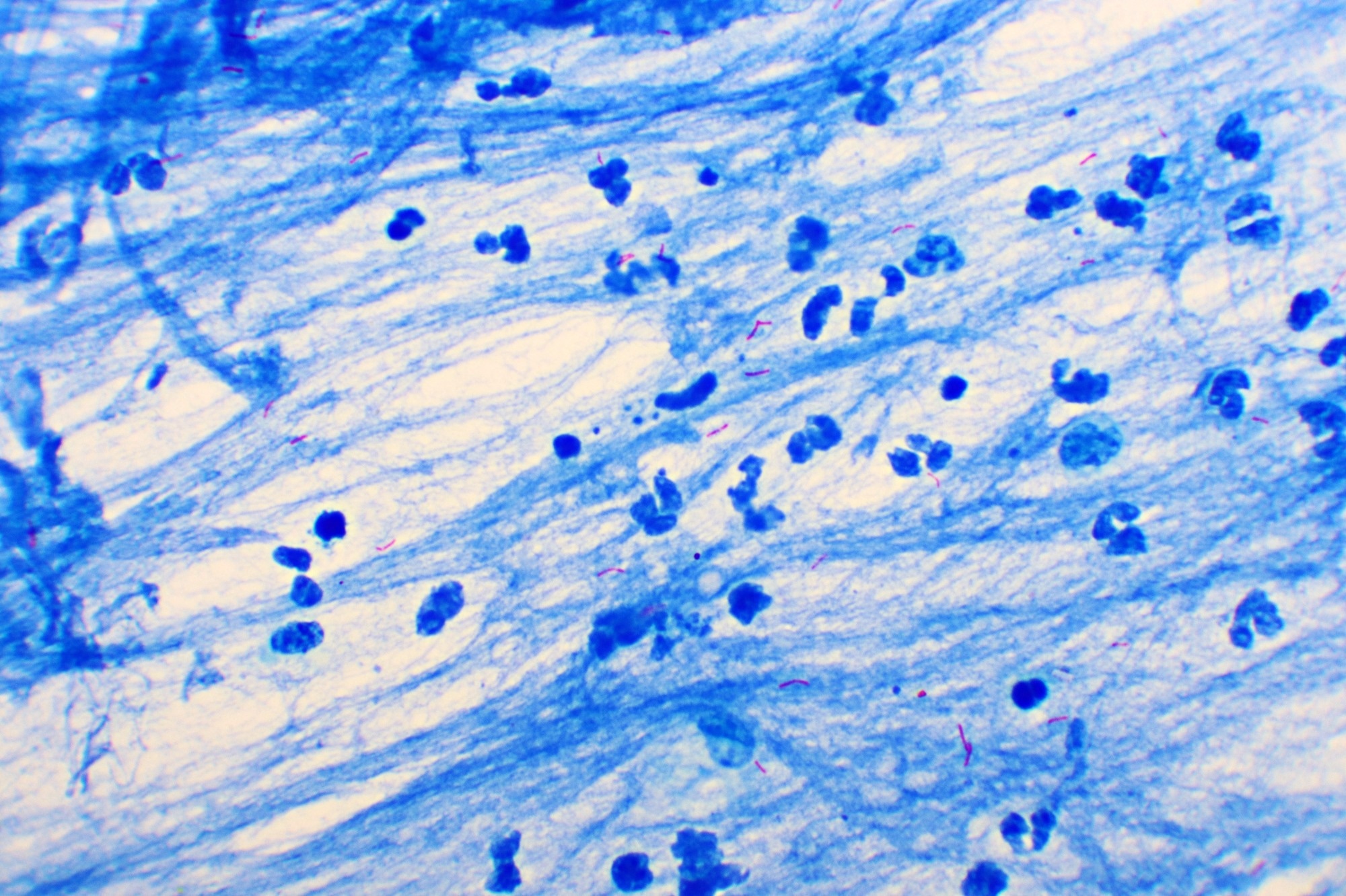 ​​​​​​​Study: Whole genome CRISPRi screening identifies druggable vulnerabilities in an isoniazid resistant strain of Mycobacterium tuberculosis. Image Credit: Jarun Ontakrai/Shutterstock.com