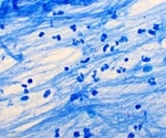 How CRISPRi is Helping Combat Drug-Resistant Tuberculosis