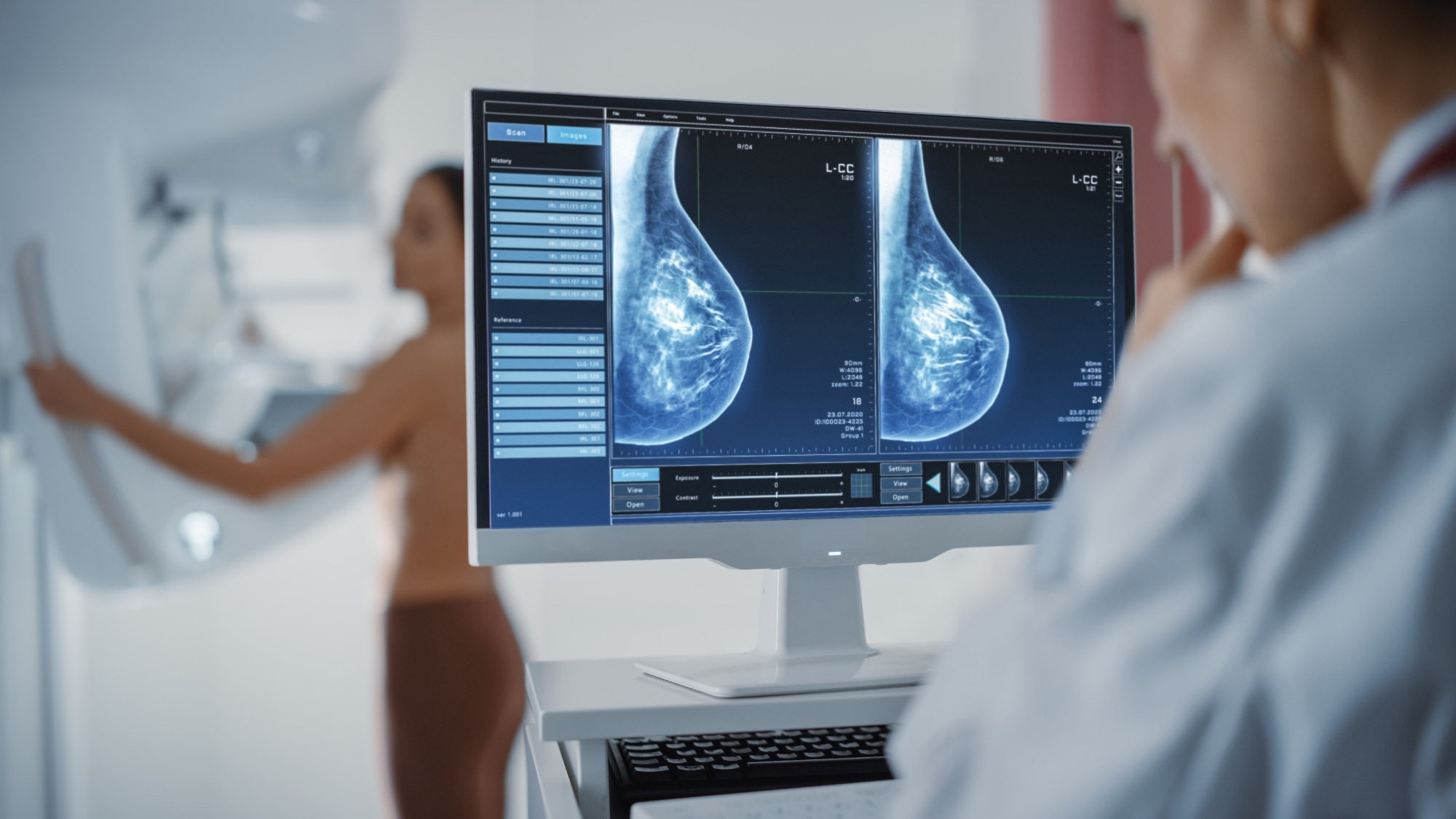 Screen Showing the Mammogram Scans of Dense Breast Tissues.