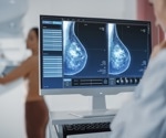 Single-Cell Sequencing Sheds Light on Breast Cancer Genetics