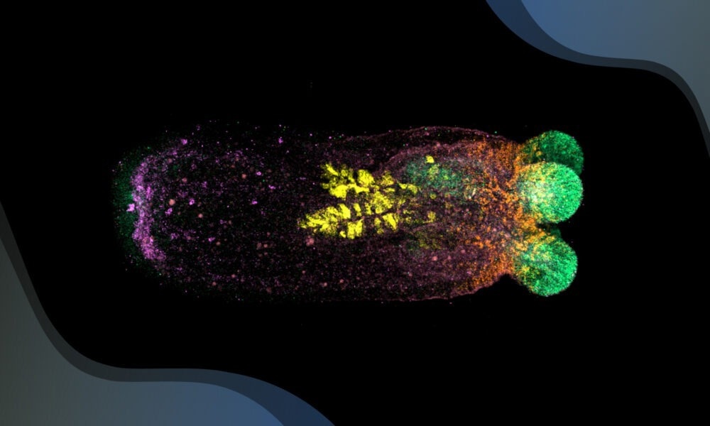 The Active Role of Homeostasis in Shaping Organism Structure