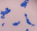 From Yeast to Humans: Decoding the Link Between Nucleolar Size and Aging