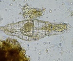 How Maternal Age and Diet Impact Fitness and Reproductive Timing in Rotifers