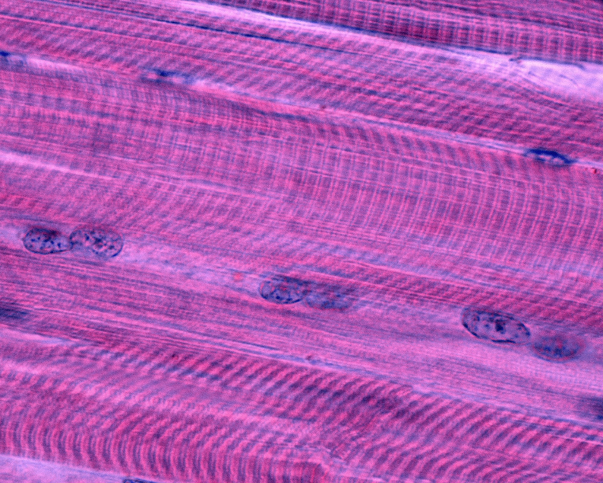 Striated skeletal muscle fibers showing the cross-striation with dark A bands and light I bands. The Z line stands out in the center of I bands. High magnification light micrograph.