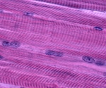 A breakthrough in muscle cell regeneration and alignment with ultrasonic vibrations.