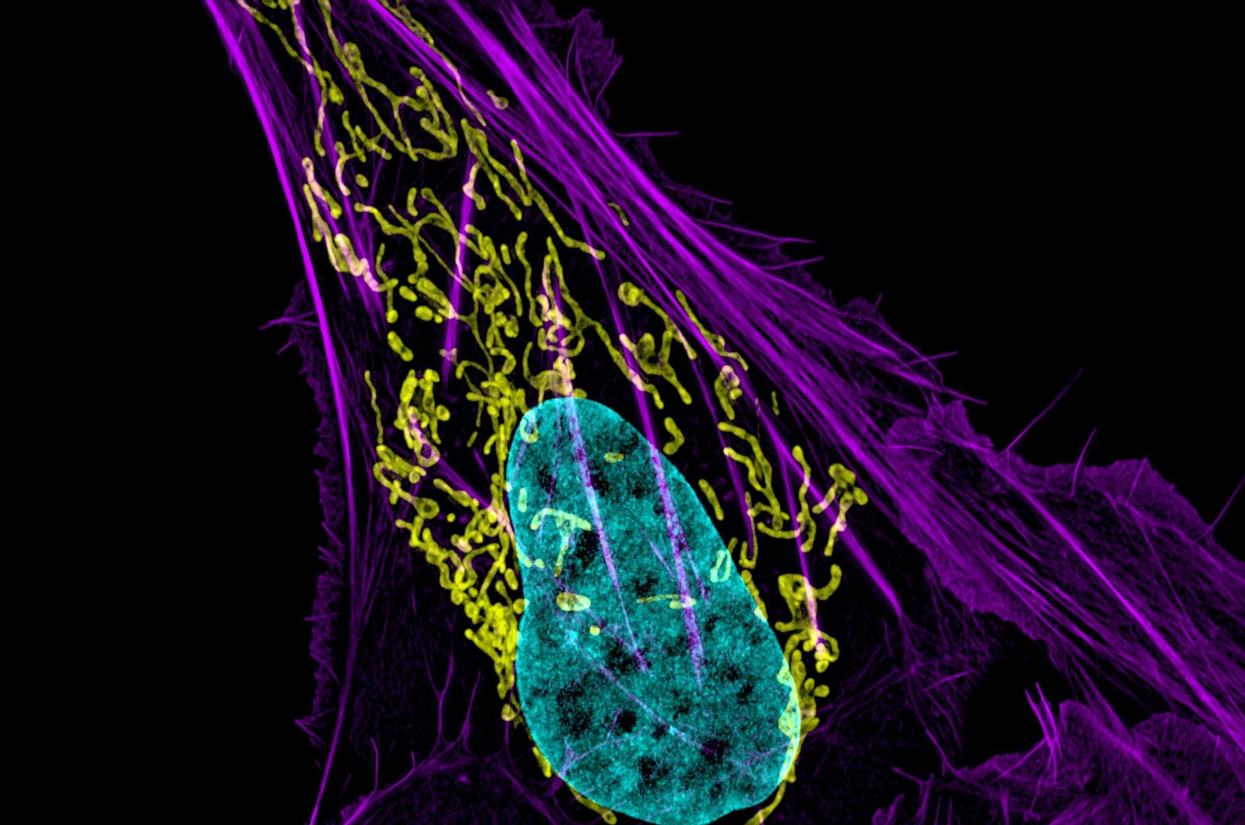 Targeting Cancer with Nanoparticle-Delivered Gene Therapy