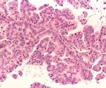 A revolutionary antibody approach to fight cancer by restoring cellular fitness