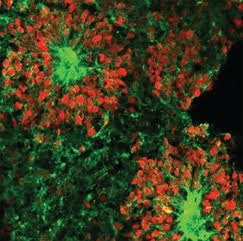 Space Experiment Reveals Surprising Brain Cell Behavior