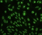 Arabidopsis Study Finds that Centromeres Call the Shots in Retrotransposon Integration
