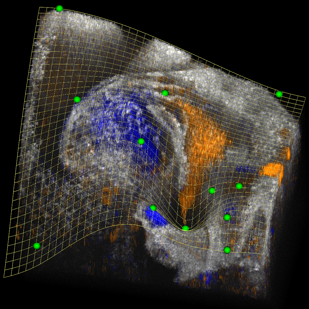New Software Reveals Unprecedented Insights into Embryonic Heart Development
