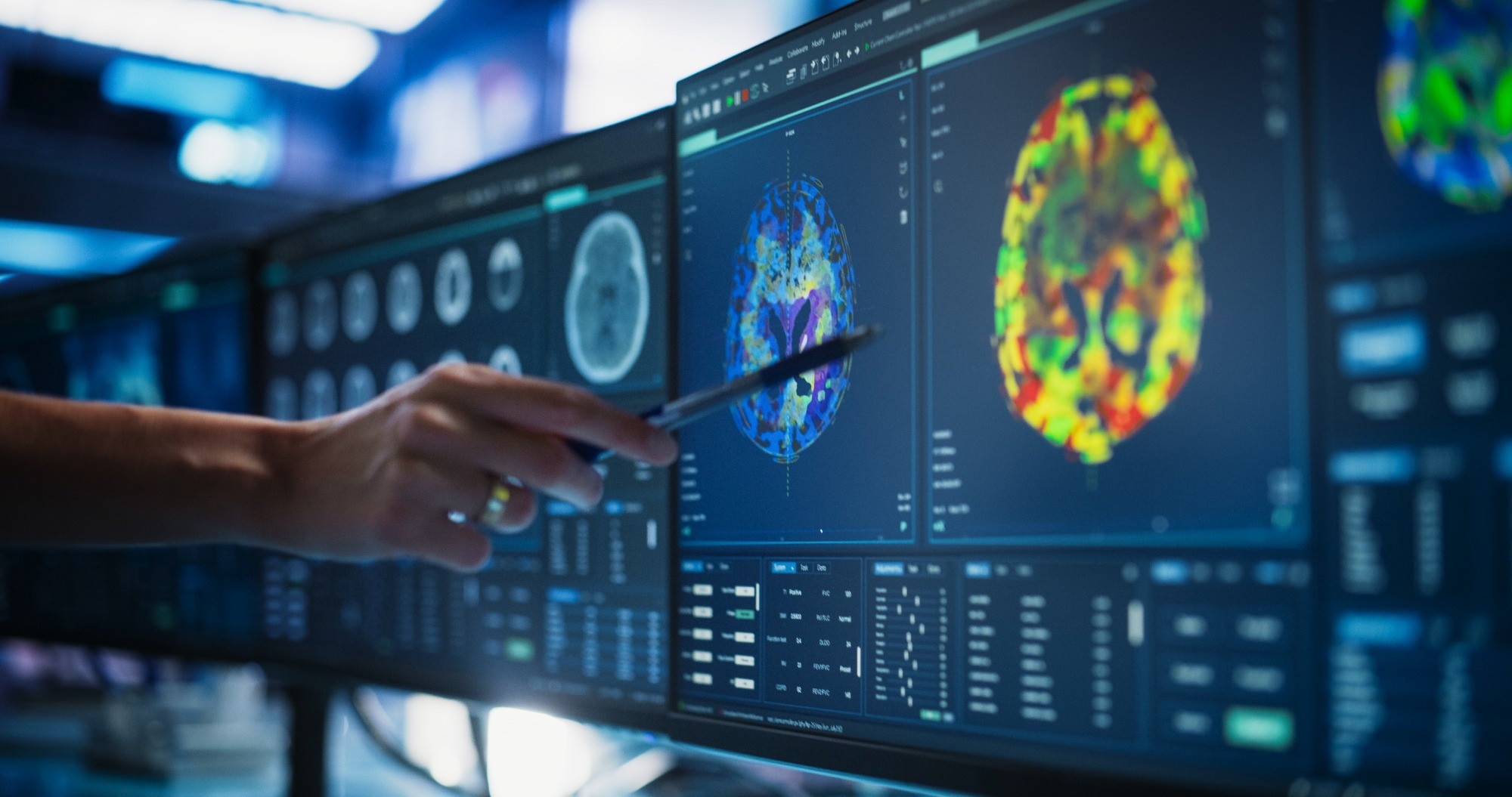 Modern Medical Research Center: Anonymous Doctor Pointing At Desktop Computer Monitor With CT Scan Of Patient