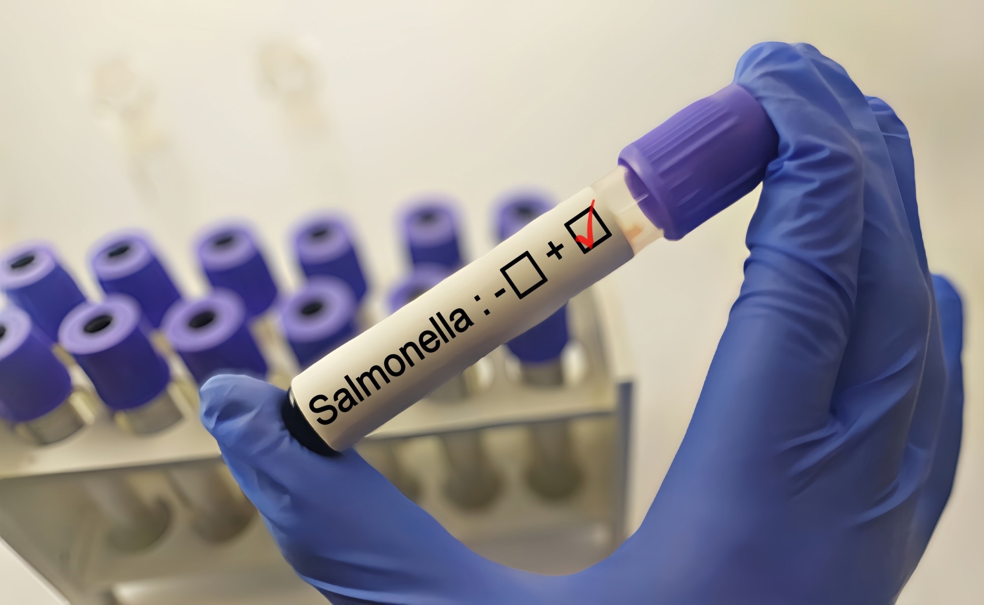 Diagnostician holding in hand a positive Salmonella bacteria test.