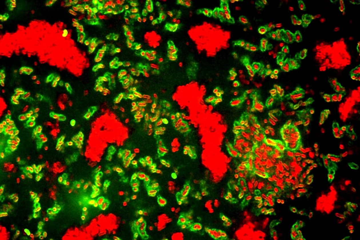New Insights into Biofilm Formation and Dispersal