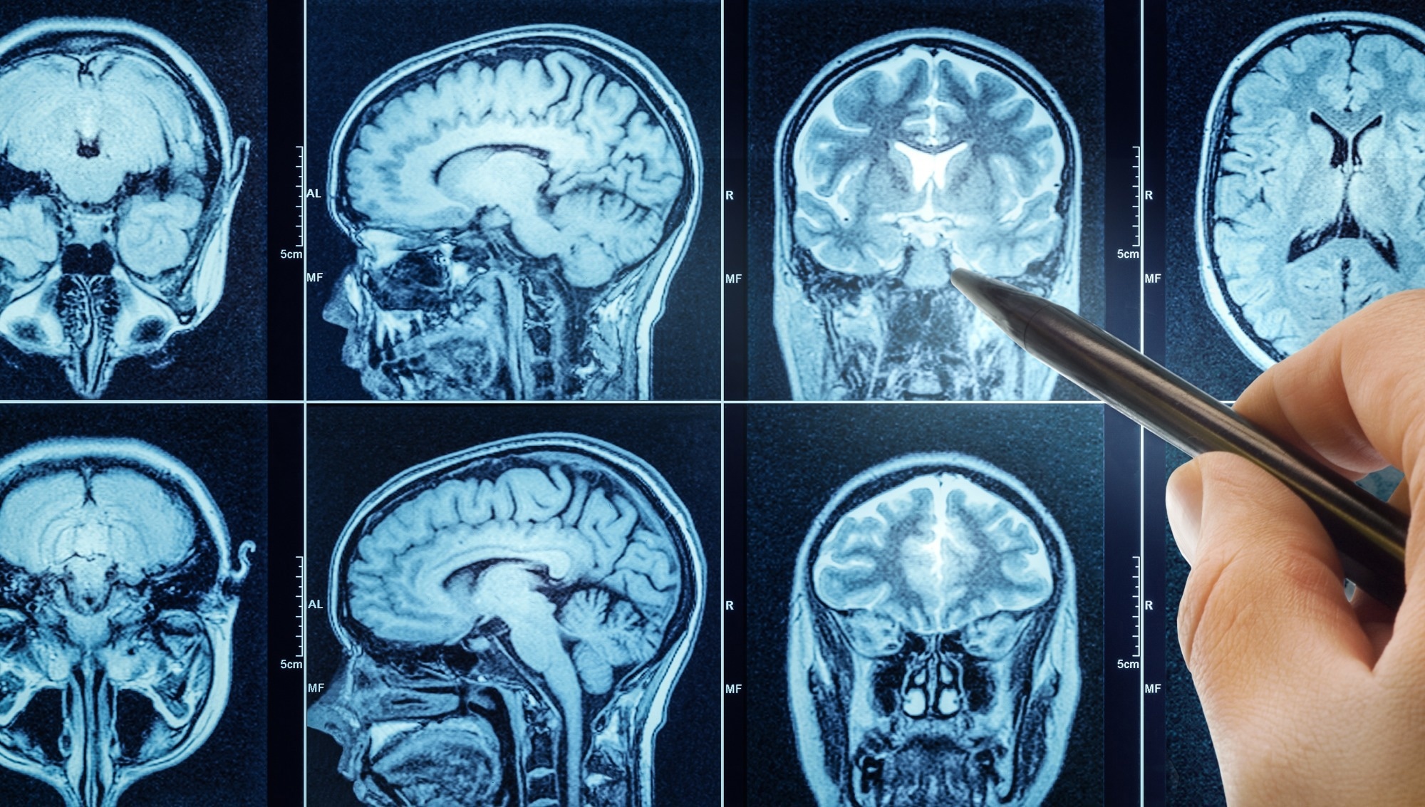 CT scan with brain and doctor