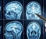 Protective ‘Slime’ In The Brain May Help Prevent Aging And Neurodegeneration