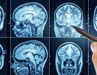 Protective ‘Slime’ In The Brain May Help Prevent Aging And Neurodegeneration