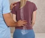 Can Tissue Engineering and Regenerative Medicine Reverse Spinal Cord Injuries?