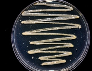 How P. syringae Outsmarts Amoeba with Chemical Surveillance and Strikes