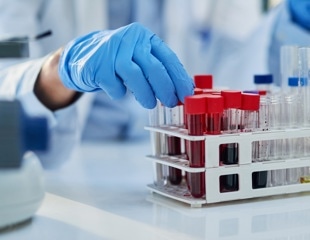 New Blood Test Could Revolutionize Alzheimer’s Diagnosis