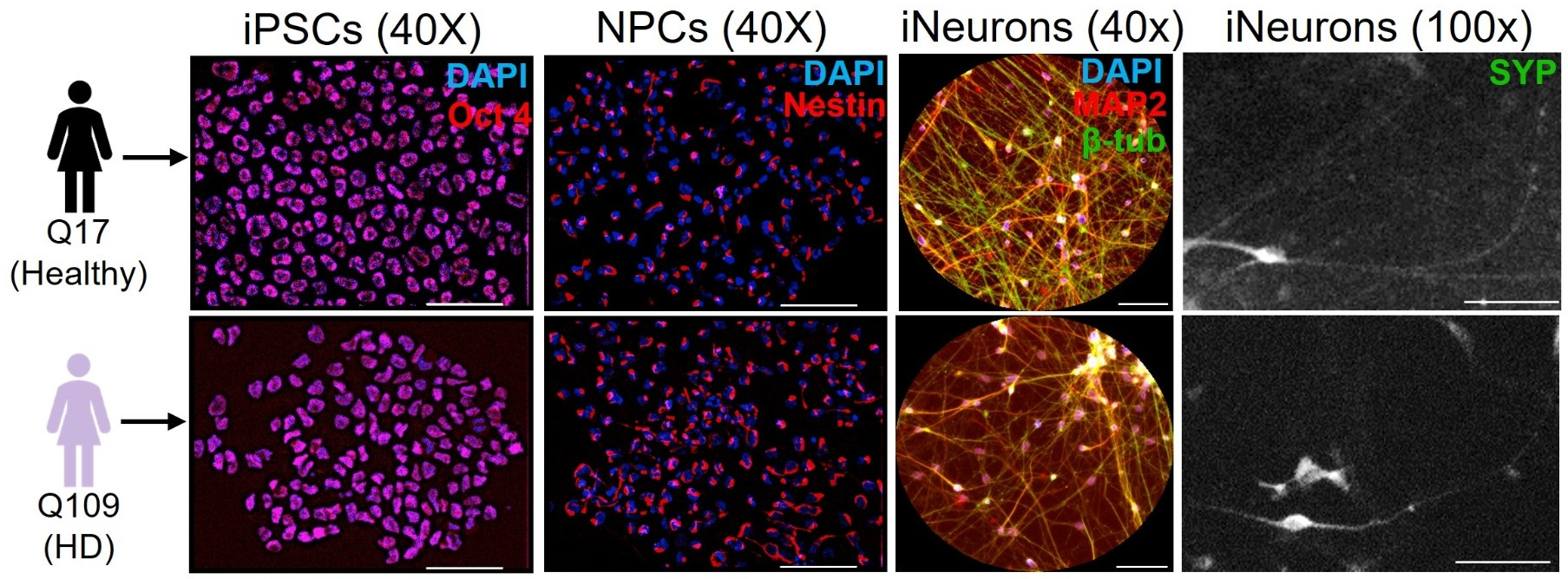 Key Regulators of Mutant Huntingtin Protein in Neuronal Transport