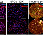 Key Regulators of Mutant Huntingtin Protein in Neuronal Transport