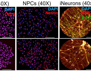 Key Regulators of Mutant Huntingtin Protein in Neuronal Transport